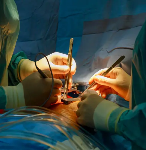 Surgical Gastroenterology